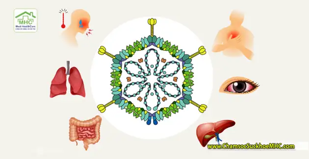 Adenovirus là gì? Xét nghiệm Adenovirus lấy máu hay dịch tỵ hầu? 1 adenovirus gay ra benh gi