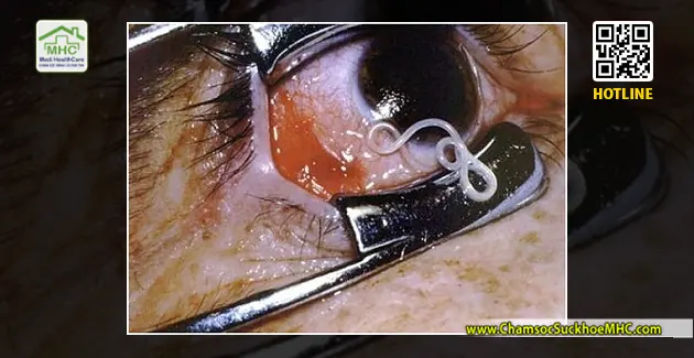 Ôm hôn, ngủ cùng thú cưng dễ mắc bệnh giun đũa chó, mèo 3 giun dua cho meo trong mat