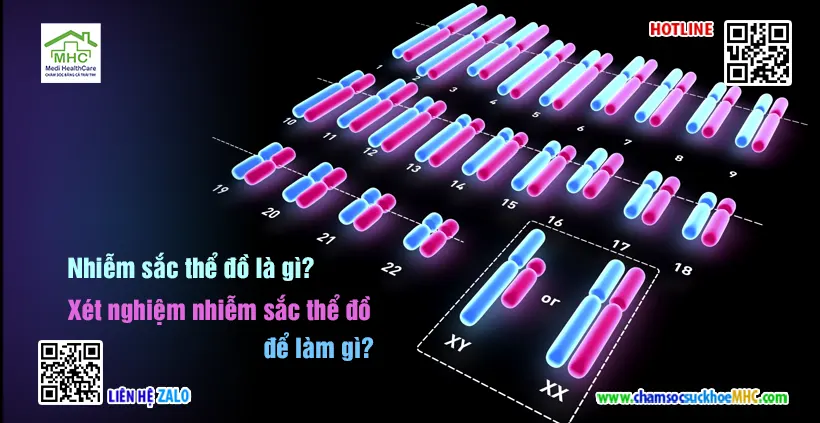 Nhiễm sắc thể đồ là gì? Xét nghiệm nhiễm sắc thể đồ để làm gì?