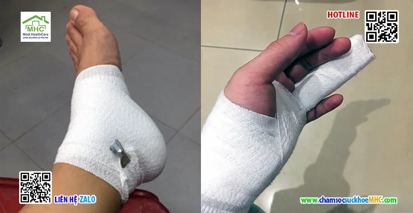 Dịch vụ thay băng tại nhà quận Tân Bình TPHCM